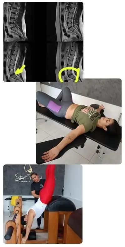 Caso de sucesso - Tamires